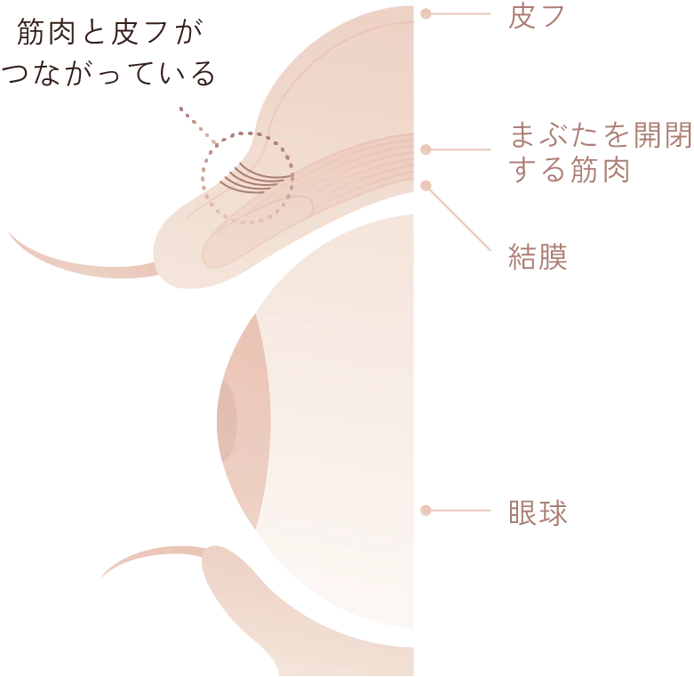 生まれつき二重まぶたの人の構造